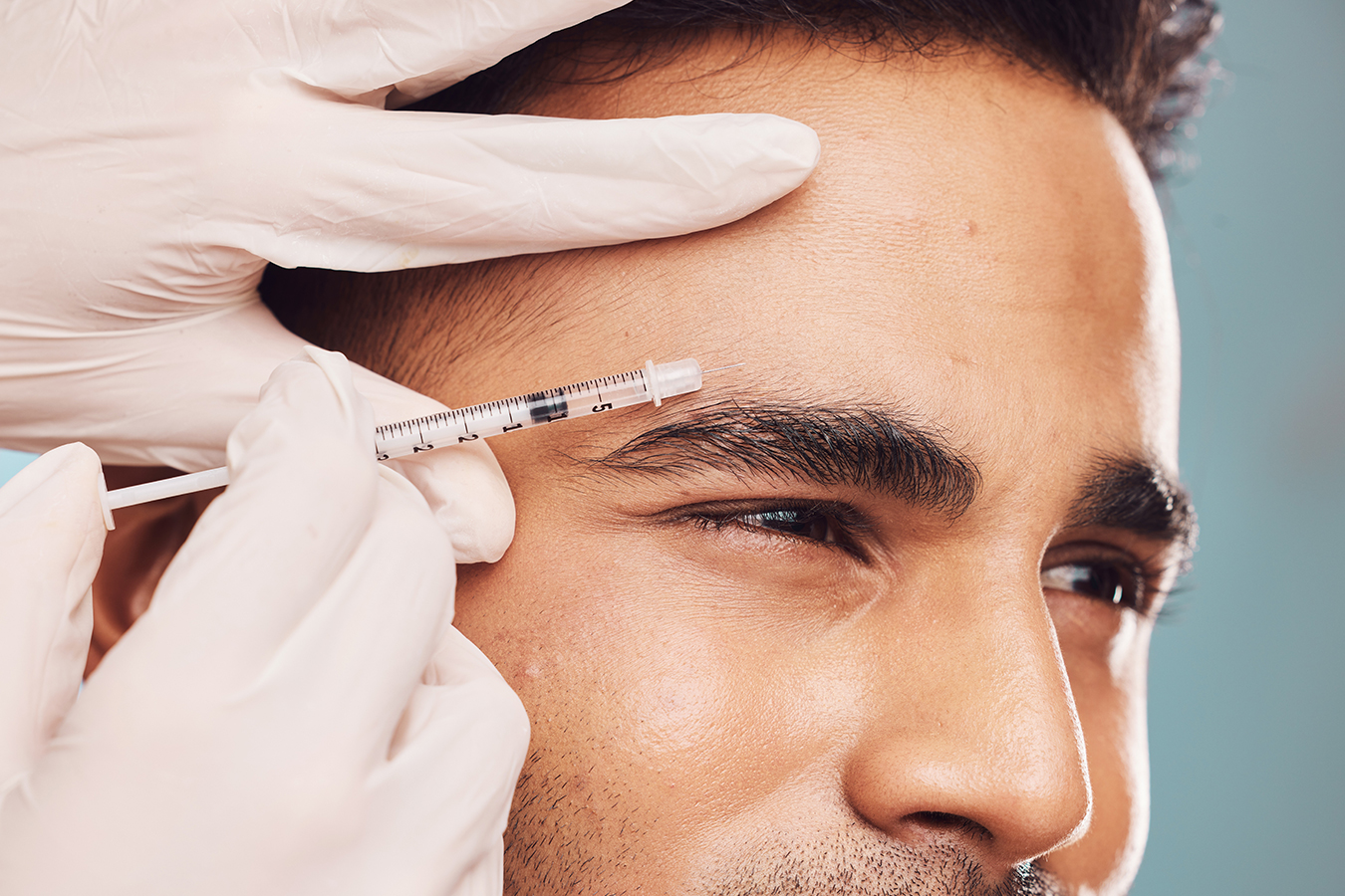 Botox y Líneas de Expresión