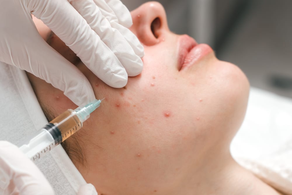 Facial Purificante Antiacné