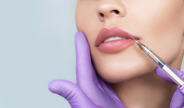 Relleno de Labios