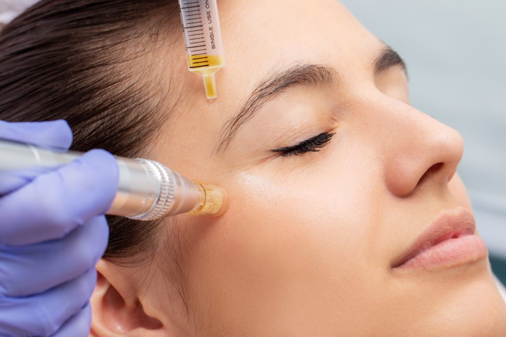 PRP Facial